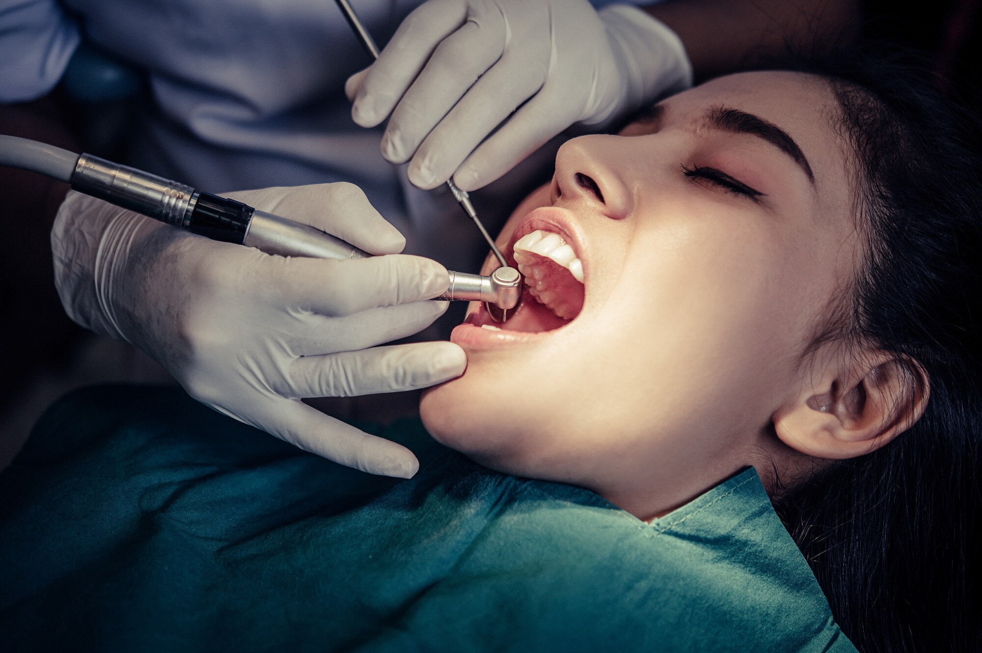 Dental Implants — Permanent Tooth Replacement