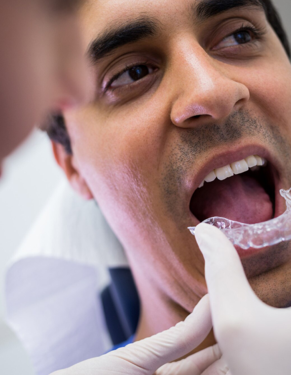 Invisalign & Clear Aligners — Modern Orthodontics